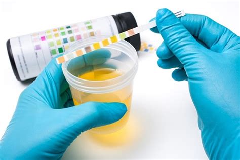 urine test at home